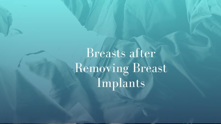 Breasts after Removing Breast Implants