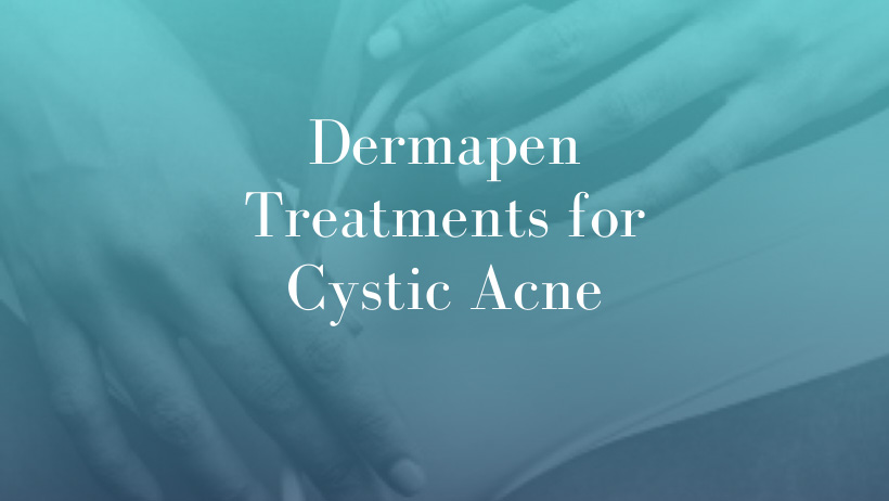 Dermapen-Treatments-for-Cystic-Acne